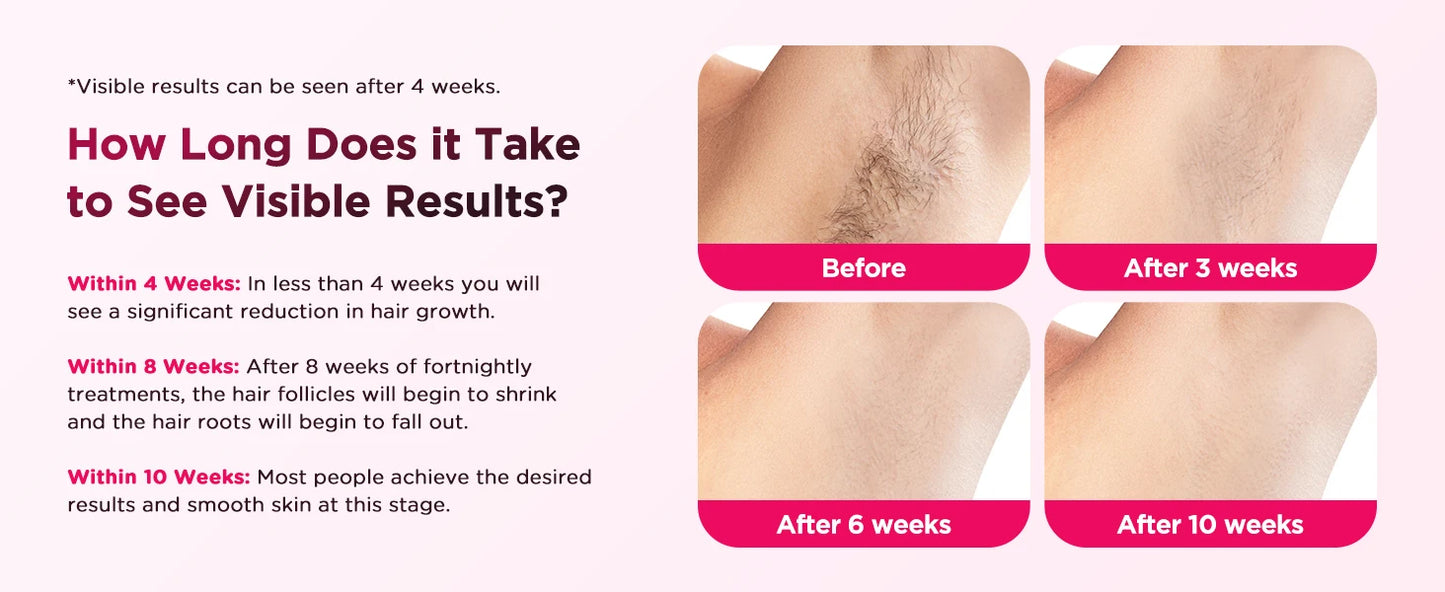 990000 Flash Laser Epilator IPL Hair Removal For Men and Women Body Bikini Facial Permanant Painless IPL Hair Remover Machine